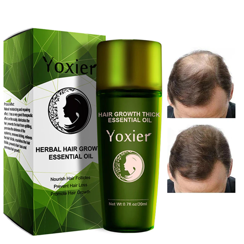 Effective Fast Growth Hair Care Serum iciCosmetic™