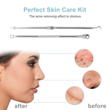 Acne blackhead removal needles
