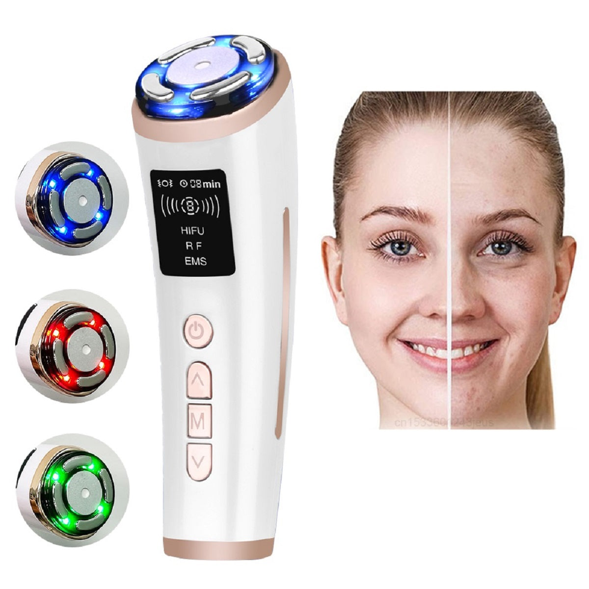 Face Lifting Skin Rejuvenation Device